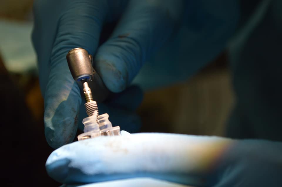 Gloved clinician loading a dental implant onto a surgical driver during a live-patient implant CE course